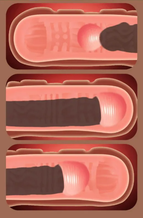 Masturbador Masculino Supertight – Textura Interna y Esfera Extraíble